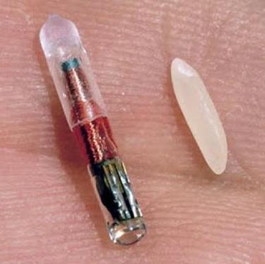 The development of high-tech, “chip implants”